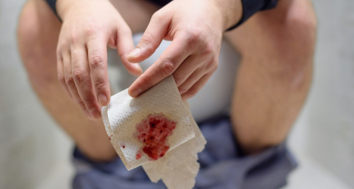 causes-of-blood-in-stool-std-gov-blog